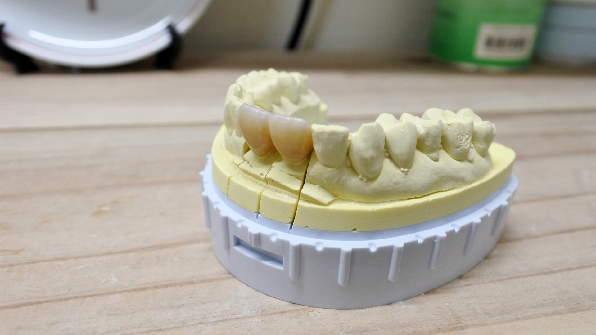 福岡県大牟田市の有限会社大牟田技工センターではCAD/CAMを導入し、あらゆる歯科技工に対応しております。